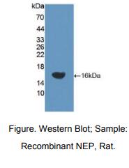 大鼠脑啡肽酶(CD10)多克隆抗体