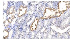 人肾脏脑蛋白(KIBRA)多克隆抗体