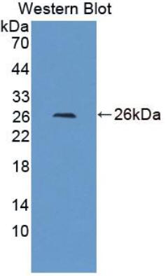 大鼠酰基辅酶A氧化酶2(ACOX2)多克隆抗体
