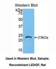 https://msimg.bioon.com/bionline/goods-no-pic.png