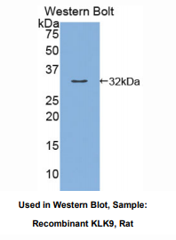 https://msimg.bioon.com/bionline/goods-no-pic.png