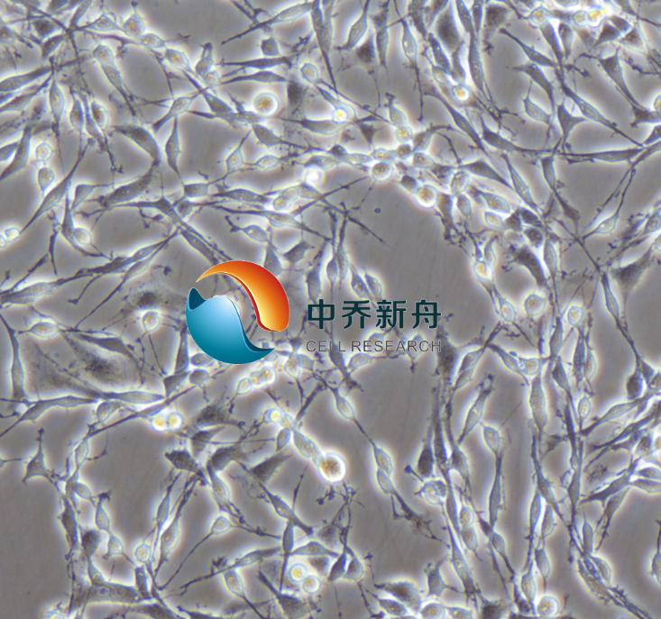 https://img.medsci.cn/8eee53bbc4cb7a98de615e72115896bc4e27fda5cbb764dbd67d9d641c2bb46a.png