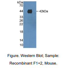 https://msimg.bioon.com/bionline/goods-no-pic.png