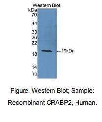 人细胞维甲酸结合蛋白2(CRABP2)多克隆抗体