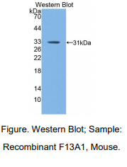 https://msimg.bioon.com/bionline/goods-no-pic.png