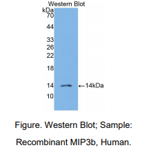 https://msimg.bioon.com/bionline/goods-no-pic.png