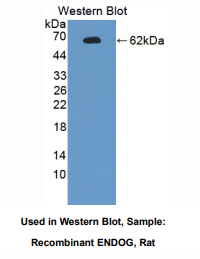 https://msimg.bioon.com/bionline/goods-no-pic.png