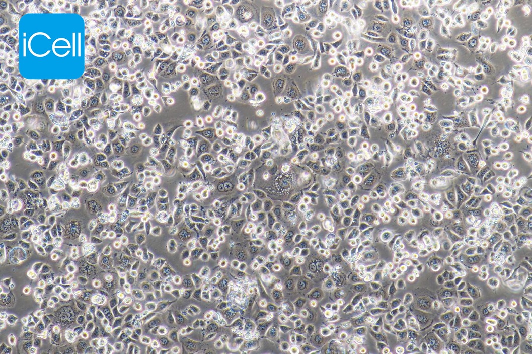 https://img.medsci.cn/5f561f9d1966c8a40c069b97fcac23b82666d7612246dbae75064de0bed04333.png
