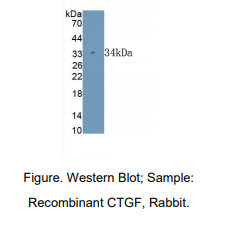 兔结缔组织生长因子(CTGF)多克隆抗体