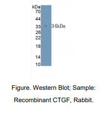 https://msimg.bioon.com/bionline/goods-no-pic.png