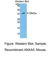 小鼠膜联蛋白A5(ANXA5)多克隆抗体