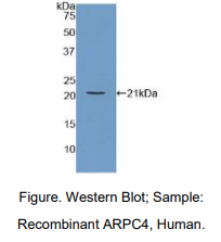 人肌动蛋白相关蛋白2/3复合体亚基4(ARPC4)多克隆抗体