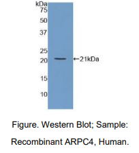 https://msimg.bioon.com/bionline/goods-no-pic.png