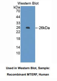 https://msimg.bioon.com/bionline/goods-no-pic.png