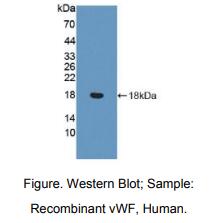 https://msimg.bioon.com/bionline/goods-no-pic.png