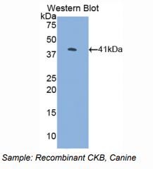 https://msimg.bioon.com/bionline/goods-no-pic.png