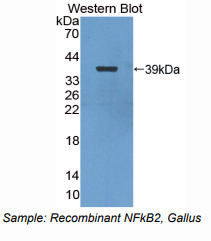鸡核因子κB2(NFkB2)多克隆抗体