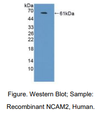 人神经细胞黏附分子2(NCAM2)多克隆抗体