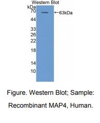 https://msimg.bioon.com/bionline/goods-no-pic.png