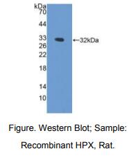 https://msimg.bioon.com/bionline/goods-no-pic.png