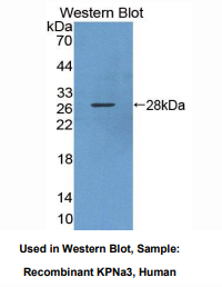 https://msimg.bioon.com/bionline/goods-no-pic.png