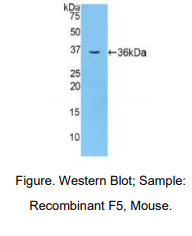 https://msimg.bioon.com/bionline/goods-no-pic.png