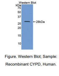 https://msimg.bioon.com/bionline/goods-no-pic.png