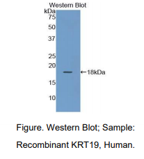 人角蛋白19(CK19)多克隆抗体