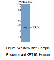 https://msimg.bioon.com/bionline/goods-no-pic.png