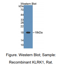 https://msimg.bioon.com/bionline/goods-no-pic.png