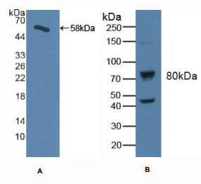 https://msimg.bioon.com/bionline/goods-no-pic.png