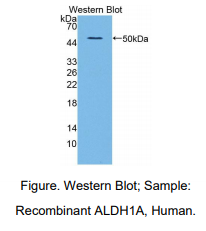 人醛脱氢酶1家族成员A2(ALDH1A2)多克隆抗体