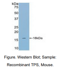 https://msimg.bioon.com/bionline/goods-no-pic.png