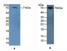 小鼠丝氨酸蛋白酶抑制剂A10(SERPINA10)多克隆抗体