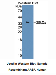 人芳基硫酸酯酶F(ARSF)多克隆抗体