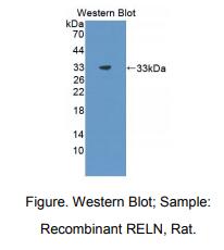 大鼠络丝蛋白(RELN)多克隆抗体