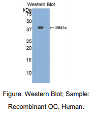 https://msimg.bioon.com/bionline/goods-no-pic.png