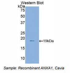 豚鼠膜联蛋白A1(ANXA1)多克隆抗体