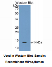 https://msimg.bioon.com/bionline/goods-no-pic.png