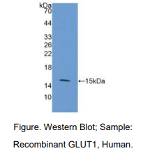 人葡萄糖转运蛋白1(GLUT1)多克隆抗体