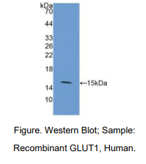 https://msimg.bioon.com/bionline/goods-no-pic.png