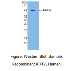 人角蛋白7(CK7)多克隆抗体