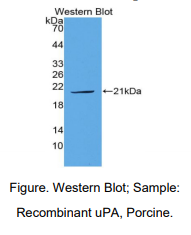 https://msimg.bioon.com/bionline/goods-no-pic.png