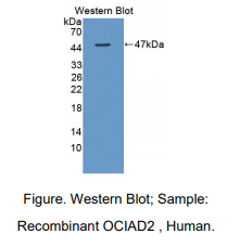 人含卵巢癌免疫反应抗原域蛋白2(OCIAD2)多克隆抗体