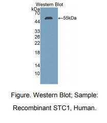 人斯钙素1(STC1)多克隆抗体