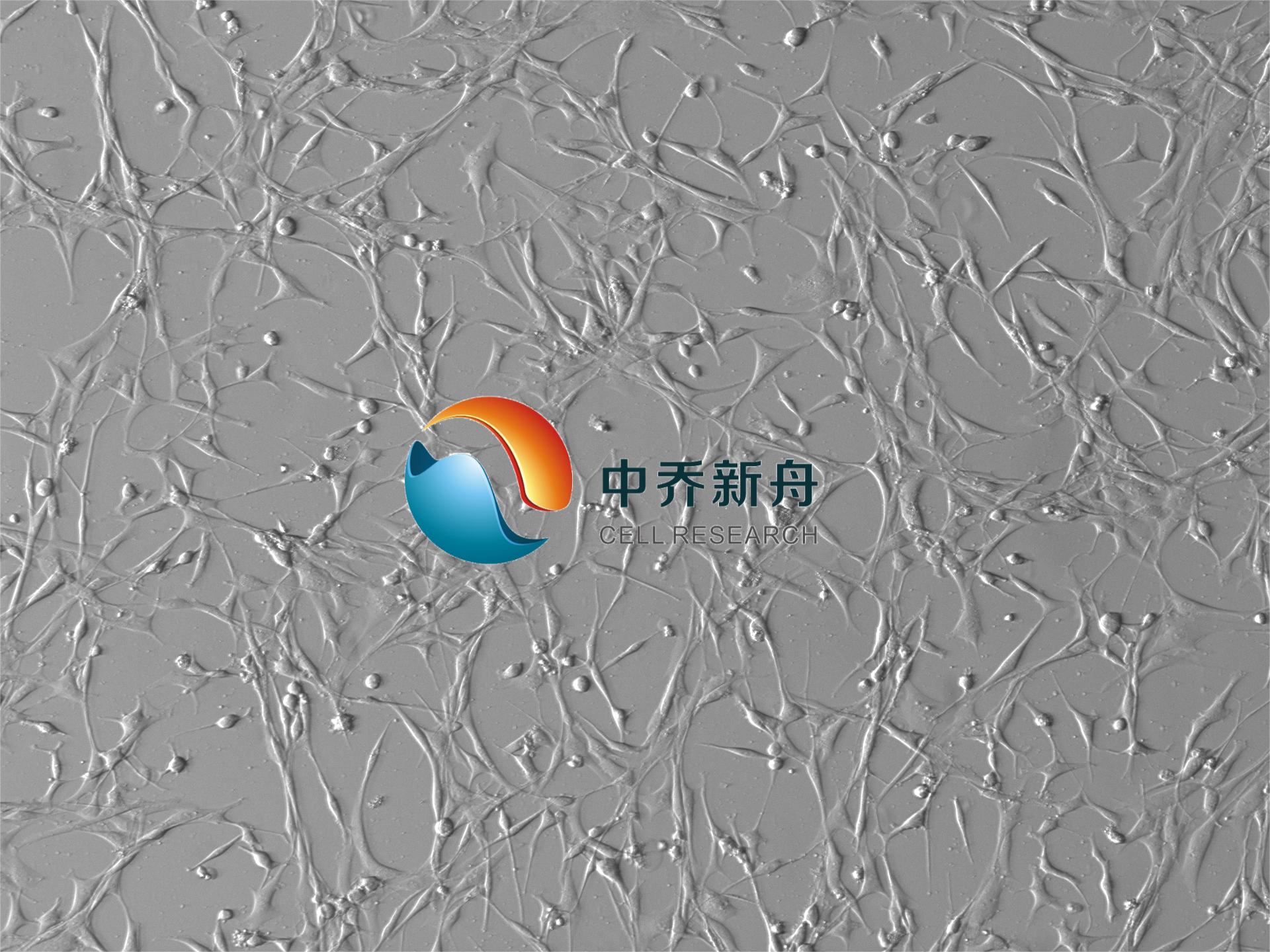 人类风湿关节炎滑膜成纤维细胞-永生化