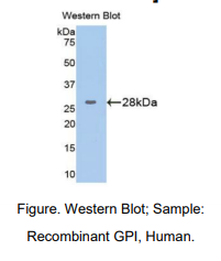 https://msimg.bioon.com/bionline/goods-no-pic.png