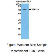 https://msimg.bioon.com/bionline/goods-no-pic.png