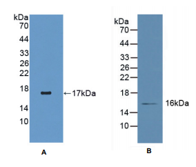 人视黄醇结合蛋白5(RBP5)多克隆抗体
