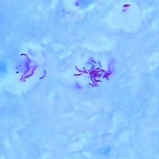 https://msimg.bioon.com/bionline/goods-no-pic.png
